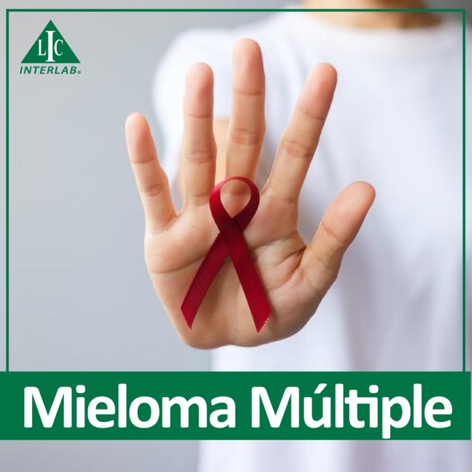 Diágnostico del Mieloma Múltiple