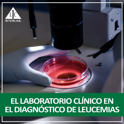 El laboratorio clínico en el diagnóstico de leucemias