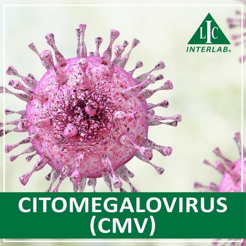 Citomegalovirus (CMV)