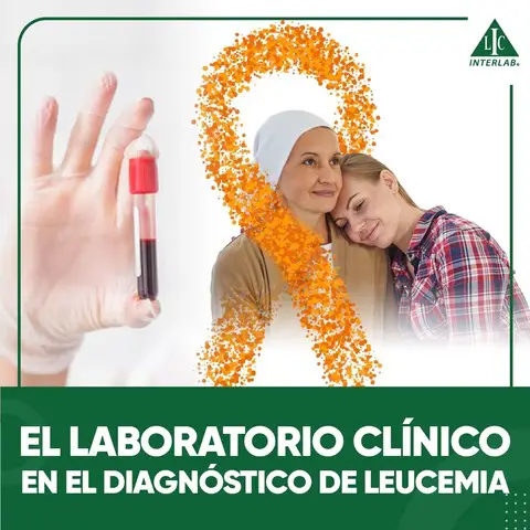 El laboratorio clínico en el diagnóstico de leucemias
