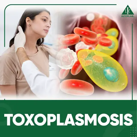Toxoplasmosis